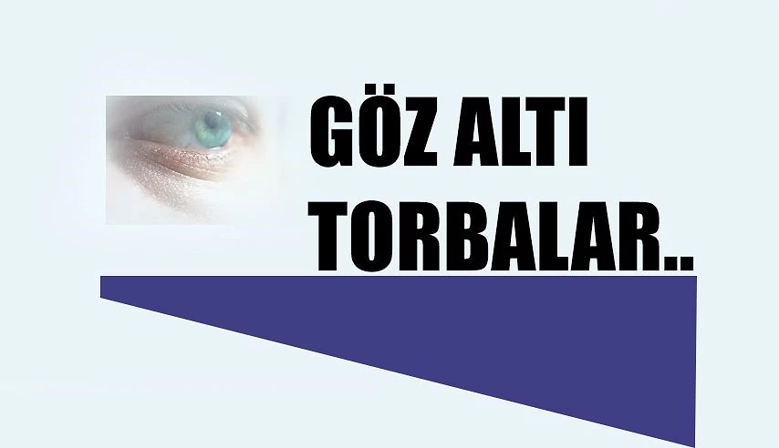 Göz Altı Torbalarına Ameliyatsız ve Acısız Tedavi