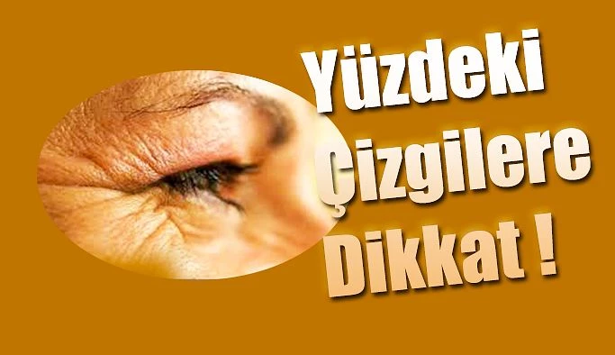 YÜZDEKİ ÇİZGİLERE DİKKAT !